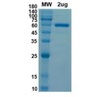 Terminal Deoxynucleotidyl Transferase