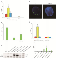 低氧/厌氧产品案例——低氧与视网膜病变