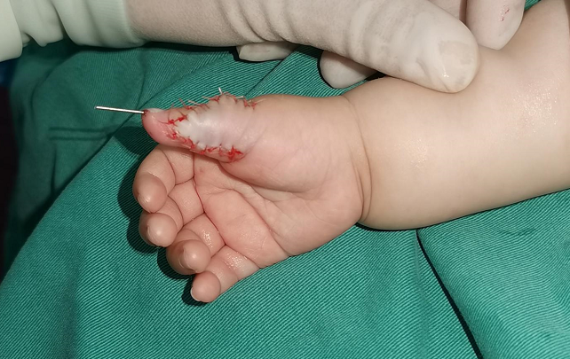 从云南到郑州 1900 多公里求医路!看完泪目……