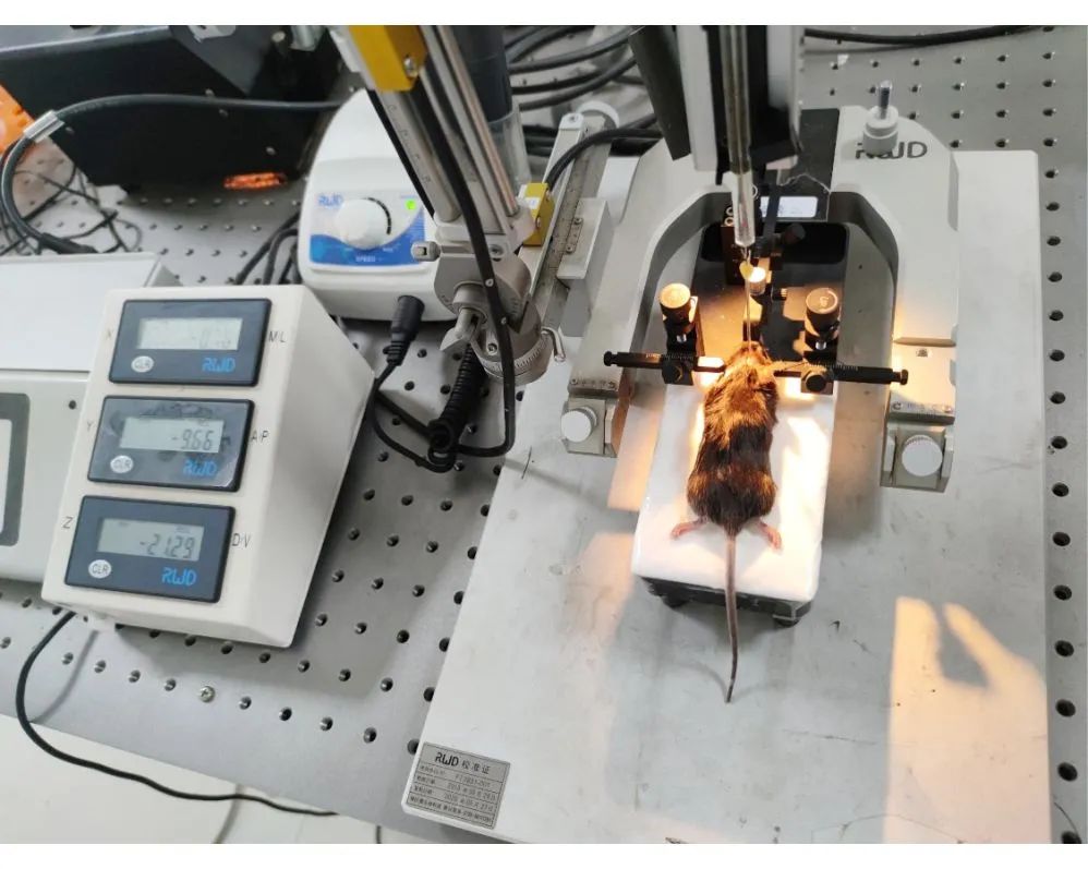 脑立体定位注射技术服务