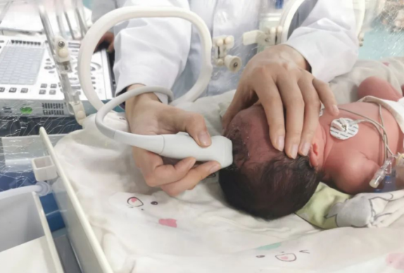 刚出生的宝宝也要做超声——新生儿颅脑超声，你知道吗？