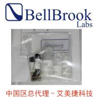 【干冰】重组DDX3酶,活性,人(1,000ug)|Recombinant DDX3 Enzyme