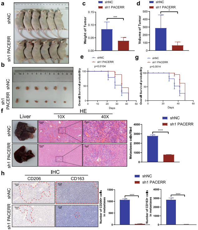在胰管腺癌中,LncRNA-PACERR通过与miR-671-3p和m6A-reader IGF2BP2相互作用诱导肿瘤前巨噬细胞