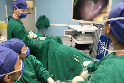 广西壮族自治区人民医院东院院区为一名肥胖患者切除卵巢巨大畸胎瘤及子宫肌瘤