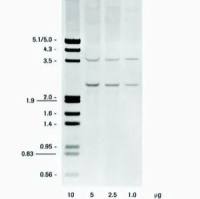 DIG DNA Labeling and Detection Kit 11093657910 现货特价