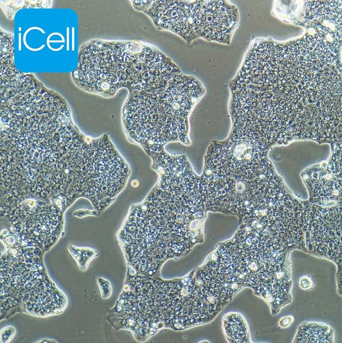 NCI-N87人胃癌细胞  STR鉴定 赛百慷（iCell）