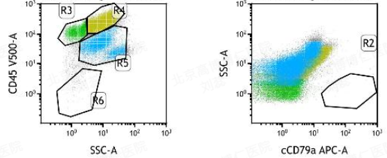 胡凯：CD19&CD22 CAR-T 治疗失败的弥漫大 B 细胞淋巴瘤的挽救性治疗