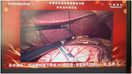 华润武钢总医院食管裂孔疝及胃食管反流病外科治疗研讨会圆满举行