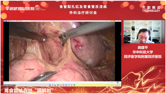 华润武钢总医院食管裂孔疝及胃食管反流病外科治疗研讨会圆满举行