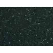 ​人原代肾小球系膜细胞