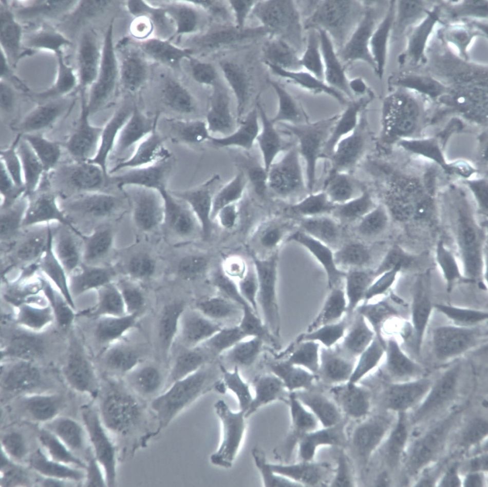 KTC-1 人甲状腺癌细胞