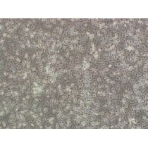 人原代输子宫平滑肌细胞