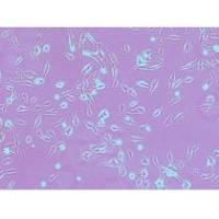 MX-1人乳腺癌细胞