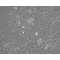 ATCC CCL-119(CCRF-CEM)人急性淋巴细胞白血病T淋巴细胞