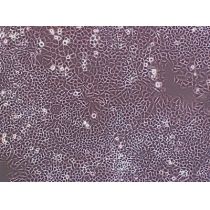 KLE人子宫内膜腺癌细胞