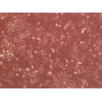 MDA-MB-453人乳腺癌细胞
