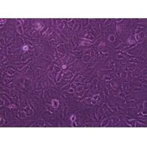 NCI-H1650人非小细胞肺癌细胞/人肺支气管癌细胞 