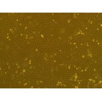 MuM-2C人侵袭性脉络膜黑色素瘤细胞