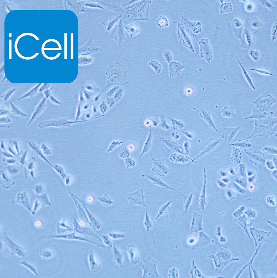 HBE135-E6E7 人支气管上皮细胞/STR鉴定