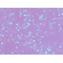 B16小鼠黑色素瘤细胞