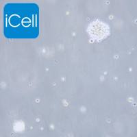 NK92、nk92细胞、nk-92细胞、nk-92、人恶性非霍奇金淋巴瘤患者的自然杀伤细胞