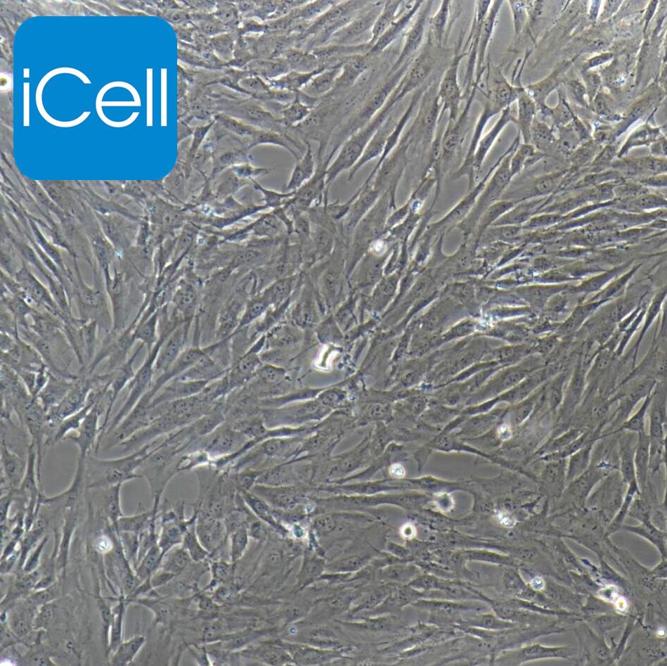 人风湿性关节滑膜成纤维细胞永生化  免疫荧光鉴定