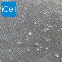 人风湿性关节滑膜成纤维细胞永生化/免疫荧光鉴定/镜像绮点（Cellverse）
