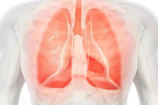 结节知多少：肺结节距离肺癌还有多远？
