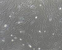 人風濕性關節滑膜成纖維細胞永生化  免疫熒光鑒定