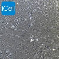 人主动脉瓣膜间质细胞永生化 免疫荧光鉴定