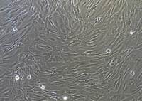 人主動脈瓣膜間質細胞永生化  免疫熒光鑒定