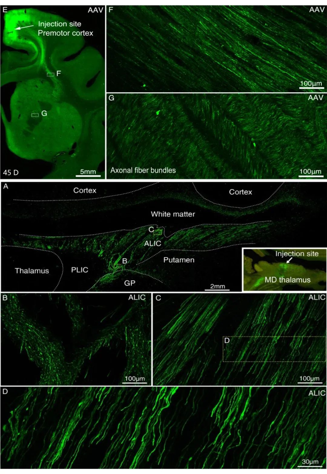 AAV、VSV和 LV在猕猴上的应用