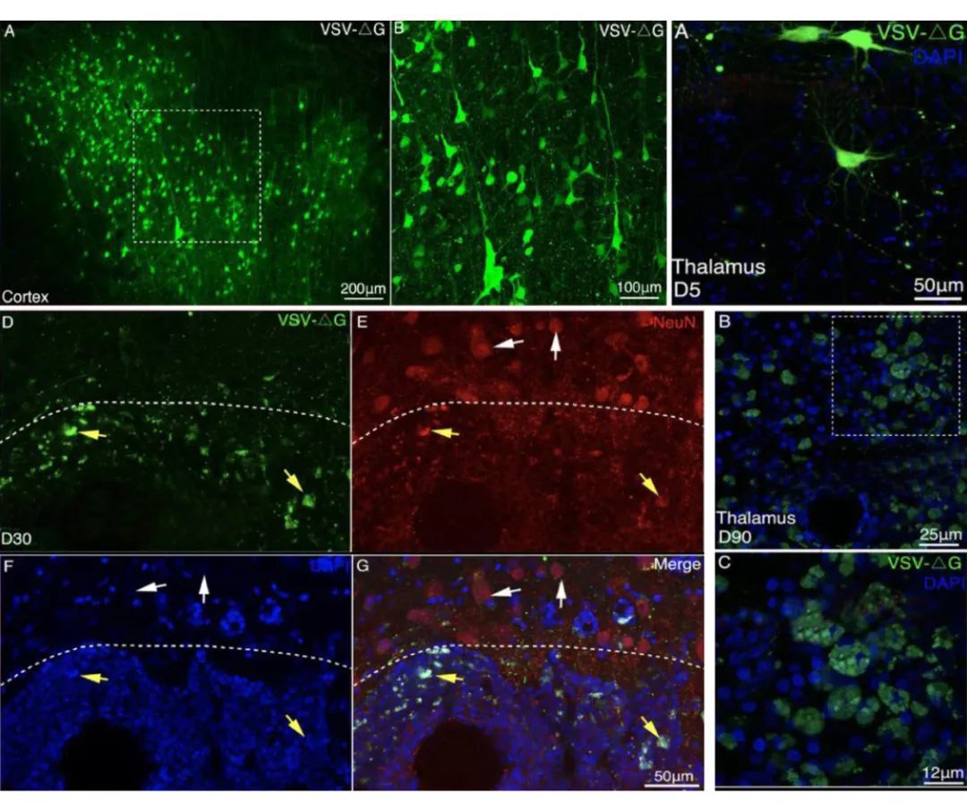 AAV、VSV和 LV在猕猴上的应用