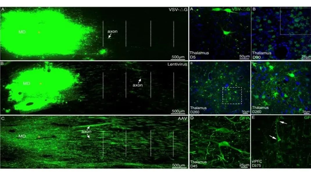 AAV、VSV和 LV在猕猴上的应用