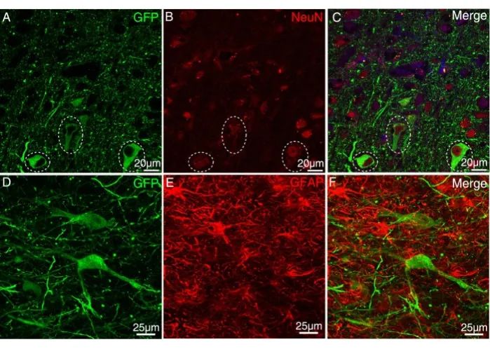 AAV、VSV和 LV在猕猴上的应用