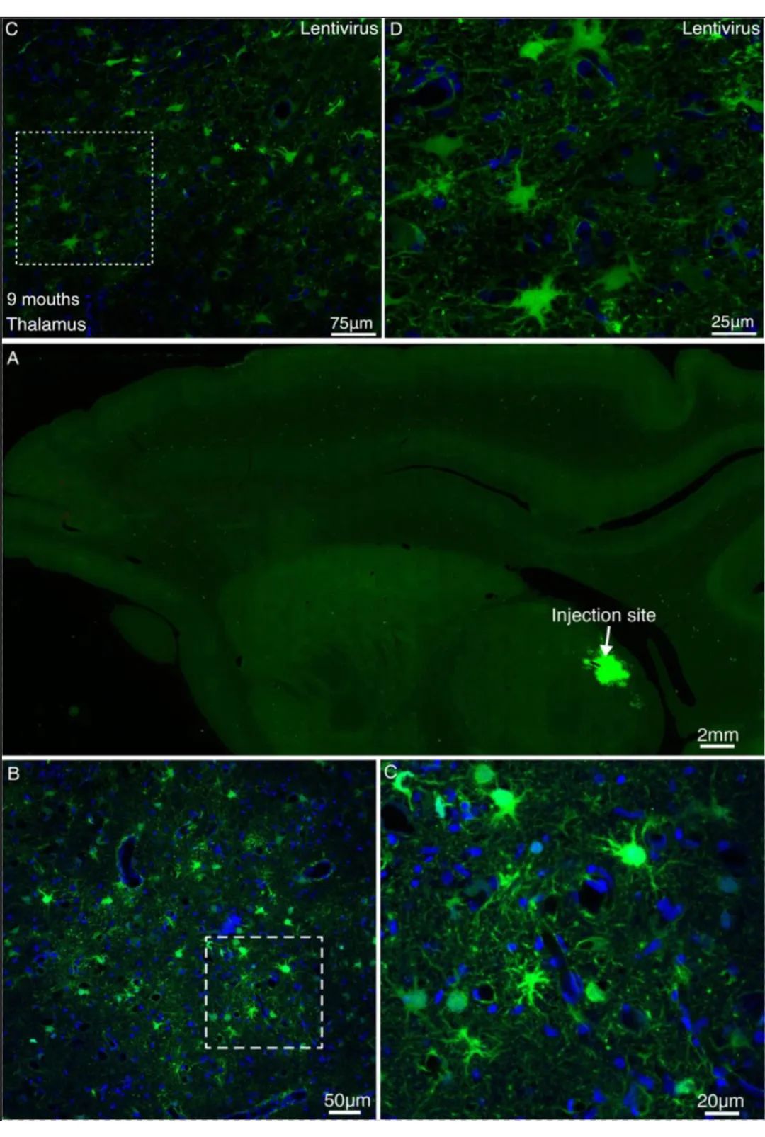 AAV、VSV和 LV在猕猴上的应用