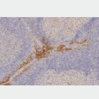 Recombinant Anti-PD-Ll antibody [28-8]重组抗PD-L1抗体