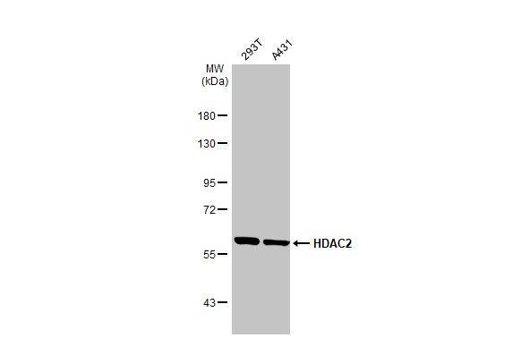 HDAC2 antibody [HL1545]