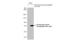 Venezuelan Equine Encephalitis Virus nsP1 antibody [HL1472]