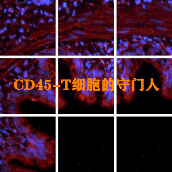 CD45--T细胞守门人
