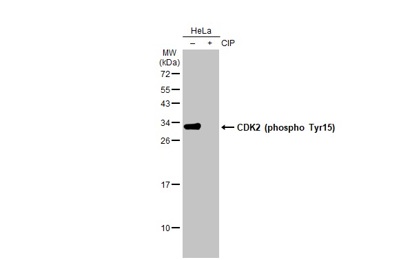 CDK2 (phospho Tyr15) antibody [HL1474]