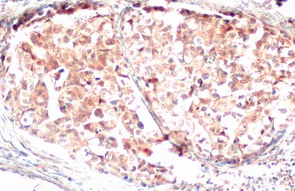 Gasdermin D antibody [HL1430]产品图