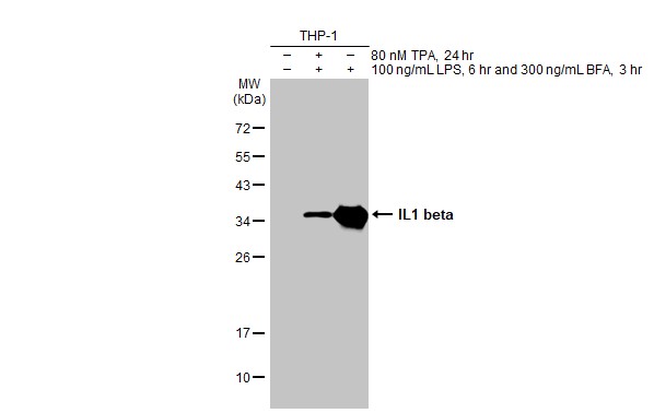 IL1 beta antibody [HL1421]