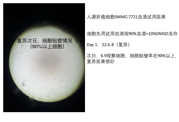 BioChannel血清培养—人源肝癌细胞SMMC-7721