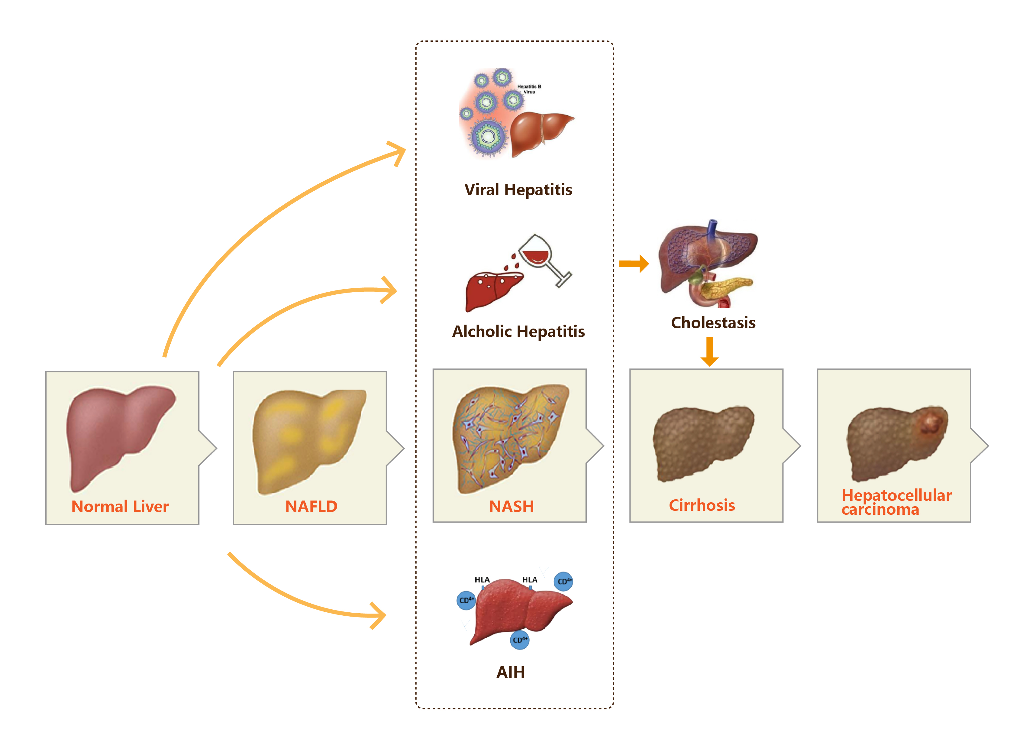 HSD17B13--新兴肝脏相关研究靶点