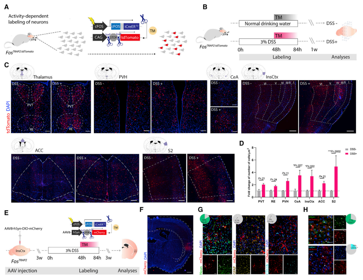 Cell：负责编码和提取特定免疫反应的神经元找到了！