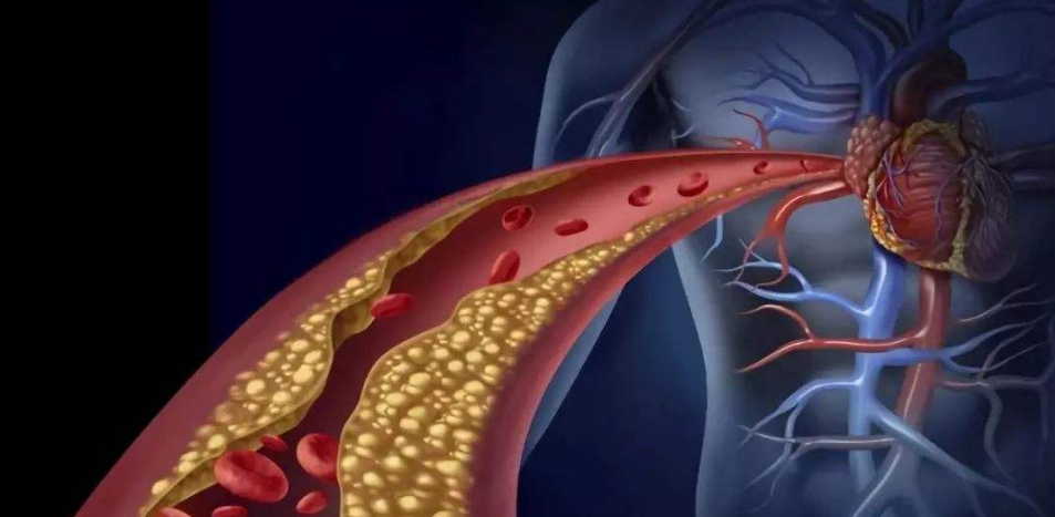 聊聊动脉粥样硬化小鼠那些事儿