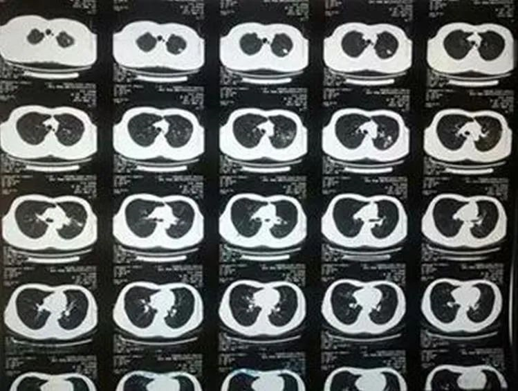 X 线、CT、磁共振，哪个更能看「透」你？影像科专家详细解读
