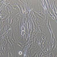 人原代肺动脉平滑肌细胞