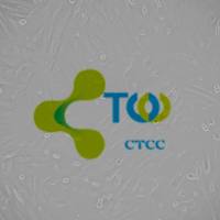 肺大静脉平滑肌细胞